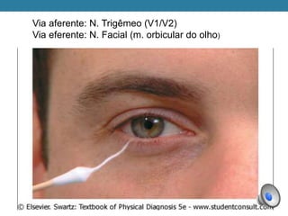 Via aferente: N. Trigêmeo (V1/V2)
Via eferente: N. Facial (m. orbicular do olho)
 