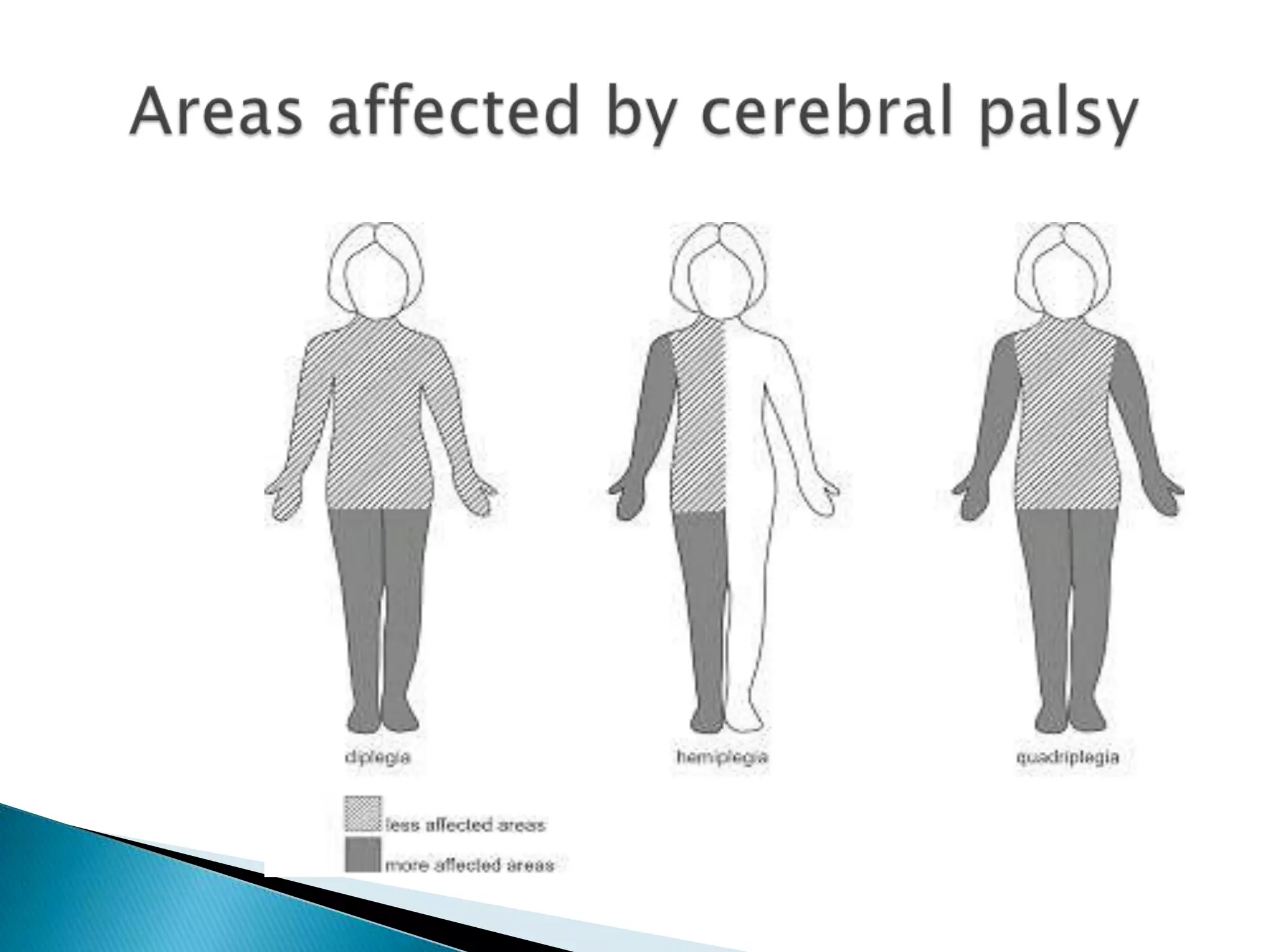 Areas affected by cerebral palsy