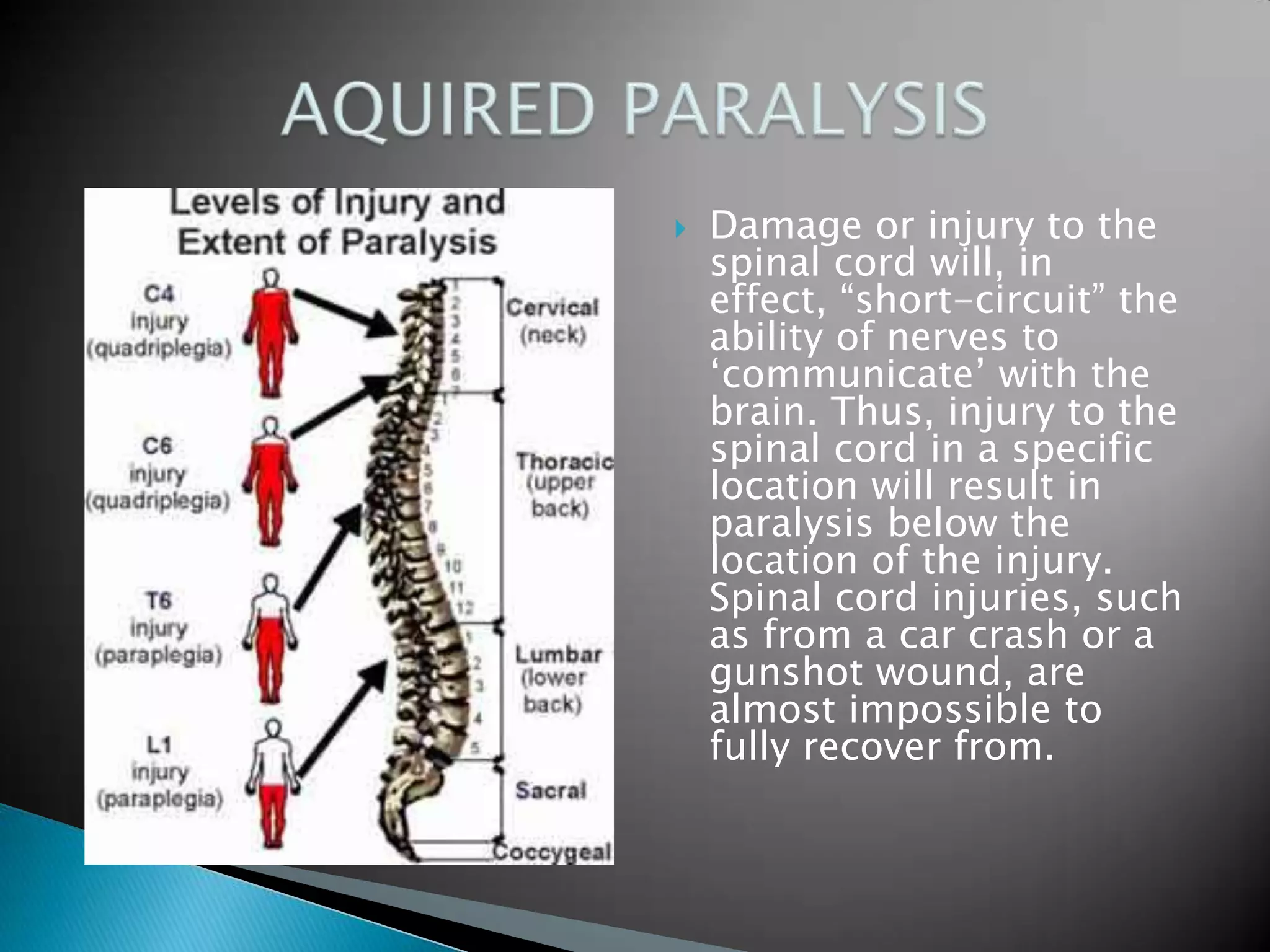 Damage or injury to the spinal cord will, in effect, “short-circuit” the ability of nerves to ‘communicate’ with the brain. Thus, injury to the spinal cord in a specific location will result in paralysis below the location of the injury. Spinal cord injuries, such as from a car crash or a gunshot wound, are almost impossible to fully recover from. AQUIRED PARALYSIS