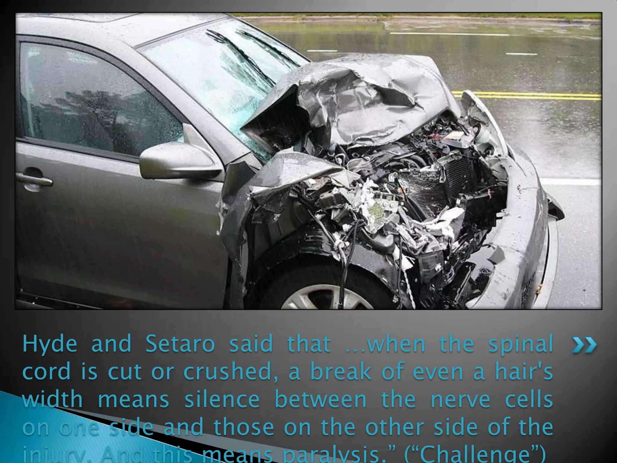 Hyde and Setaro said that …when the spinal cord is cut or crushed, a break of even a hair's width means silence between the nerve cells on one side and those on the other side of the injury. And this means paralysis.” (“Challenge”)