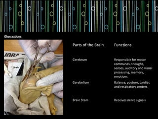 Observations:

                Parts of the Brain   Functions


                Cerebrum             Responsible for motor
                                     commands, thought,
      Brain                          senses, auditory and visual
                                     processing, memory,
                                     emotions
                Cerebellum           Balance, posture, cardiac
                                     and respiratory centers


                Brain Stem           Receives nerve signals
 