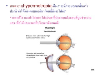 • สายตายาว(hypermetropia) คือ ภาวะที่กระบอกตาสั้นกว่า
  ปรกติ ทาให้แสงตกบนเรตินาก่อนที่มีการโฟกัส
  * การแก้ไข กระทาโดยการใส่ แว่นตาที่ประกอบด้วยเลนส์นูนช่วยรวม
  แสง เพื่อให้แสงมาตกที่บริ เวณเรตินาพอดี




                                                             144
 