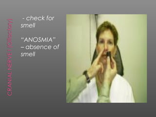 - check for
smell

“ANOSMIA”
– absence of
smell
 