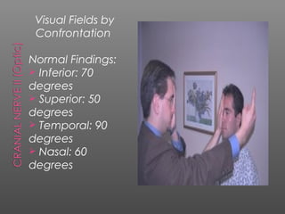 Visual Fields by
 Confrontation

Normal Findings:
 Inferior: 70
degrees
 Superior: 50
degrees
 Temporal: 90
degrees
 Nasal: 60
degrees
 