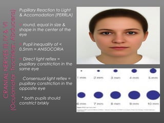 Pupillary Reaction to Light
& Accomodation (PERRLA)

 round, equal in size &
shape in the center of the
eye

 Pupil inequality of <
0.5mm = ANISOCORIA

 Direct light reflex =
pupillary constriction in the
same eye

 Consensual light reflex =
pupillary constriction in the
opposite eye

 * both pupils should
constrict briskly
 