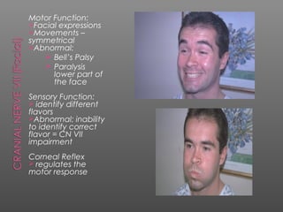 Motor Function:
Facial expressions
Movements –
symmetrical
Abnormal:
    Bell’s Palsy
    Paralysis
      lower part of
      the face
Sensory Function:
 identify different
flavors
Abnormal: inability
to identify correct
flavor = CN VII
impairment
Corneal Reflex
 regulates the
motor response
 