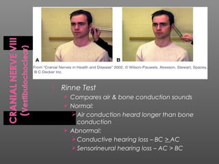    Rinne Test
     Compares air & bone conduction sounds
     Normal:
       Air conduction heard longer than bone
        conduction
     Abnormal:
       Conductive hearing loss – BC > AC
       Sensorineural hearing loss – AC > BC
 