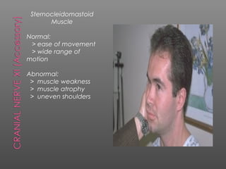 Sternocleidomastoid
       Muscle

Normal:
 > ease of movement
 > wide range of
motion

Abnormal:
 > muscle weakness
 > muscle atrophy
 > uneven shoulders
 