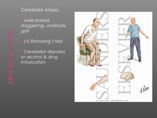 Cerebellar Ataxia

wide-based,
staggering, unsteady
gait

(+)   Romberg’s test

Cerebellar  diseases
or alcohol & drug
intoxication
 