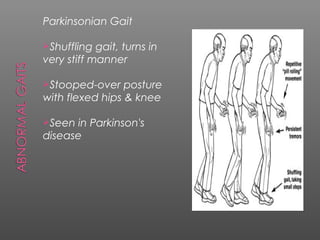Parkinsonian Gait

Shuffling  gait, turns in
very stiff manner

Stooped-over    posture
with flexed hips & knee

Seen in Parkinson's
disease
 