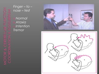 Finger – to –
nose – test

a.Normal
b.Ataxia
c.Intention
Tremor
 
