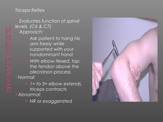 Triceps Reflex

 Evaluates function of spinal
levels (C6 & C7)
 Approach:
     Ask patient to hang his
       arm freely while
       supported with your
       nondominant hand
     With elbow flexed, tap
       the tendon above the
       olecranon process
Normal:
     1+ to 3+ elbow extends,
       triceps contracts
Abnormal:
     NR or exaggerated
 