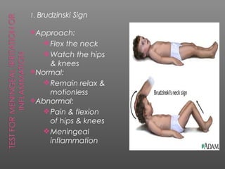 1. Brudzinski Sign

Approach:
     Flex the neck
     Watch the hips
    & knees
Normal:
   Remain relax &
    motionless
Abnormal:
   Pain & flexion
    of hips & knees
   Meningeal
    inflammation
 