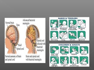 Neurological Assessment 
