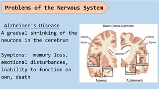 Alzheimer’s Disease
A gradual shrinking of the
neurons in the cerebrum
Symptoms: memory loss,
emotional disturbances,
inability to function on
own, death
Problems of the Nervous System
 