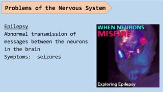 Epilepsy
Abnormal transmission of
messages between the neurons
in the brain
Symptoms: seizures
Problems of the Nervous System
 