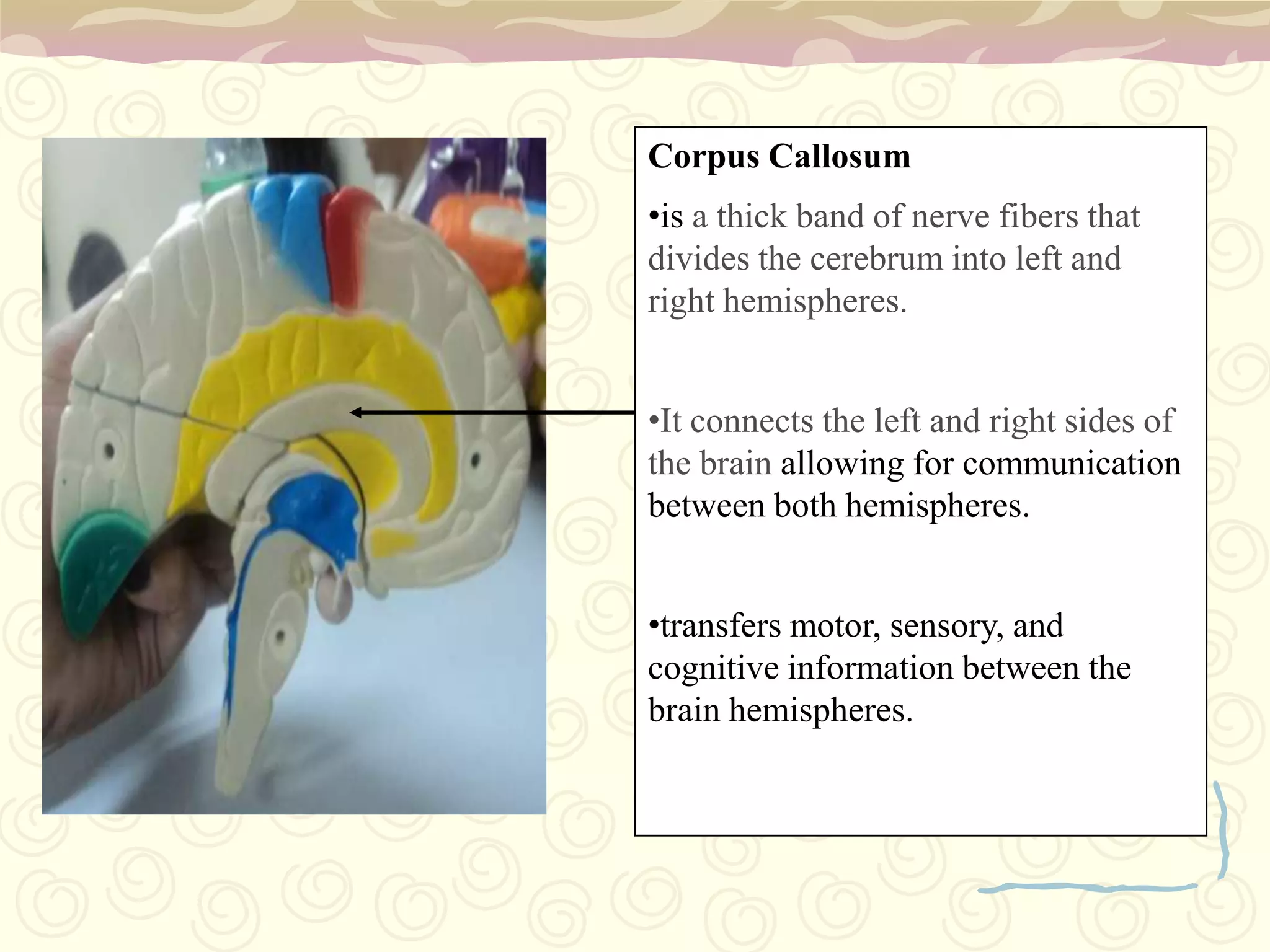 Corpus Callosumis a thick band of nerve fibers that divides the cerebrum into left and right hemispheres. 