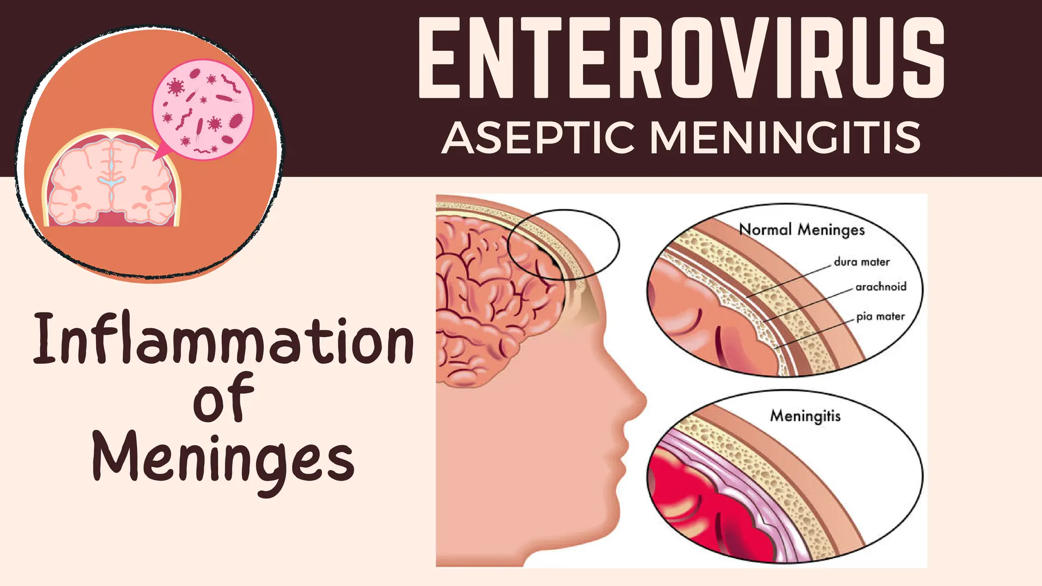 The Bacterial and Viral Infections of the Nervous System | PDF