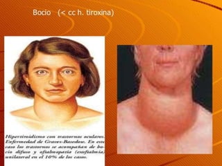 Nervous and endocrine systems.