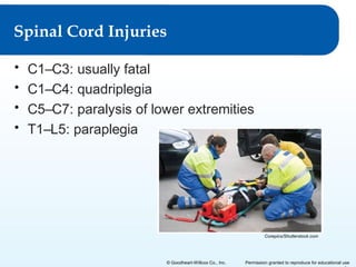 Spinal Cord Injuries
•
•
•
•

C1–C3: usually fatal
C1–C4: quadriplegia
C5–C7: paralysis of lower extremities
T1–L5: paraplegia

Corepics/Shutterstock.com

© Goodheart-Willcox Co., Inc.

Permission granted to reproduce for educational use

 