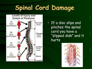 Spinal Cord Damage  If a disc slips and pinches the spinal cord you have a “slipped disk” and it hurts 