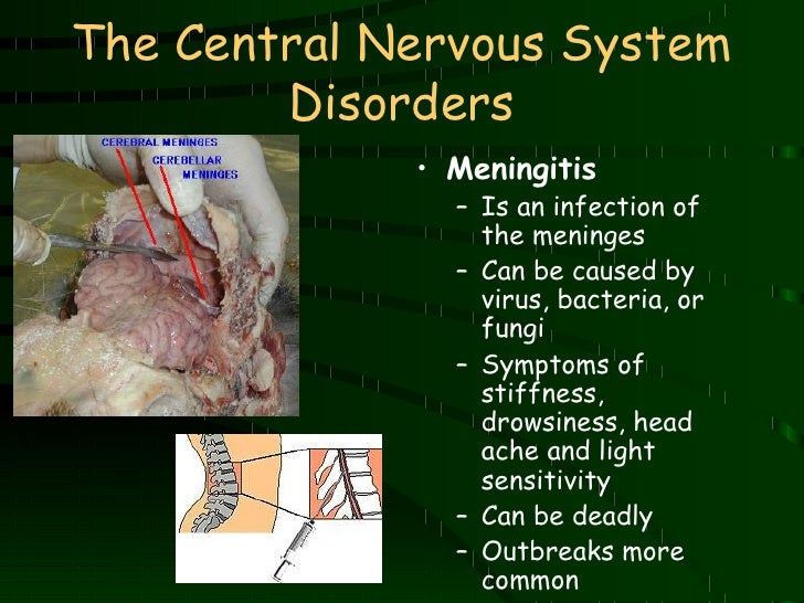 Nervous system