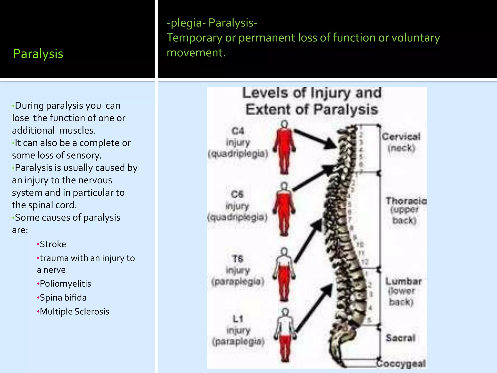 -plegia- Paralysis-
                                  Temporary or permanent loss of function or voluntary
Paralysis                         movement.



•During paralysis you   can
lose the function of one or
additional muscles.
•It can also be a complete or
some loss of sensory.
•Paralysis is usually caused by
an injury to the nervous
system and in particular to
the spinal cord.
•Some causes of paralysis
are:
      •Stroke
      •trauma with an injury to
      a nerve
      •Poliomyelitis
      •Spina bifida
      •Multiple Sclerosis
 