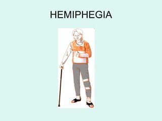 HEMIPHEGIA
