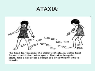 ATAXIA:
