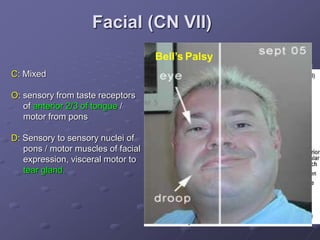Facial (CN VII)
C: Mixed
O: sensory from taste receptors
of anterior 2/3 of tongue /
motor from pons
D: Sensory to sensory nuclei of
pons / motor muscles of facial
expression, visceral motor to
tear gland.
Bell’s Palsy
 