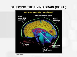 STUDYING THE LIVING BRAIN (CONT.)
 