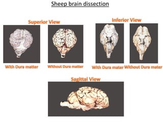 Sheep brain dissection
 