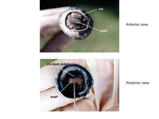 Anterior view
Posterior view
 