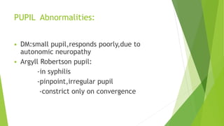 PUPIL Abnormalities:
 DM:small pupil,responds poorly,due to
autonomic neuropathy
 Argyll Robertson pupil:
-in syphilis
-pinpoint,irregular pupil
-constrict only on convergence
 