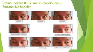 Cranial nerves III, IV and VI (continued..)
Extraocular Muscles
 