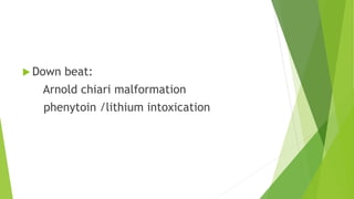  Down beat:
Arnold chiari malformation
phenytoin /lithium intoxication
 