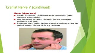Cranial Nerve V (continued)
 