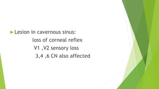  Lesion in cavernous sinus:
loss of corneal reflex
V1 ,V2 sensory loss
3,4 ,6 CN also affected
 