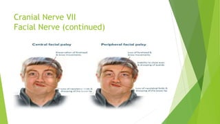 Cranial Nerve VII
Facial Nerve (continued)
 