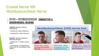 Cranial Nerve VIII
Vestibulocochlear Nerve
 