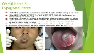 Cranial Nerve XII
Hypoglossal Nerve
 Ask the patient to move the tongue side to side in the mouth and feel the strength
 Ask the patient to open mouth and observe the tongue whether any atrophy or fasciculation
present or not.
 Ask the patient to protrude the tongue. Protruded tongue deviates to the side of lesion of 12th
nerve.
 