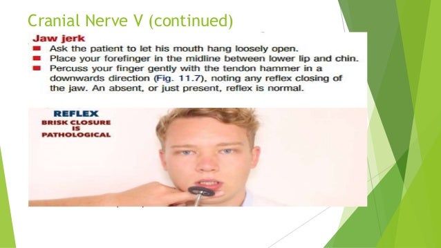 Jaw Jerk Reflex Bulbar Palsy