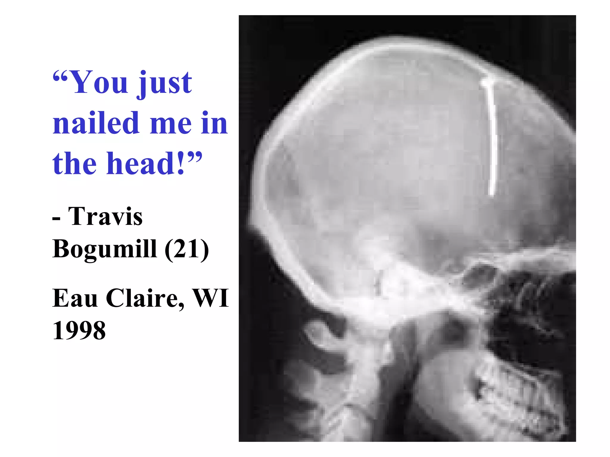 “ You just nailed me in the head!” - Travis Bogumill (21) Eau Claire, WI  1998 