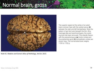 Marc Imhotep Cray MD 10
Normal brain, gross
Klatt EC. Robbins and Cotran Atlas of Pathology, 3rd Ed. 2015.
 