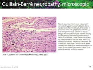 Marc Imhotep Cray MD 114
Guillain-Barré neuropathy, microscopic
Klatt EC. Robbins and Cotran Atlas of Pathology, 3rd Ed. 2015.
 