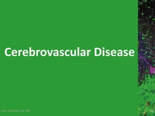 Marc Imhotep Cray MD
Cerebrovascular Disease
116
 