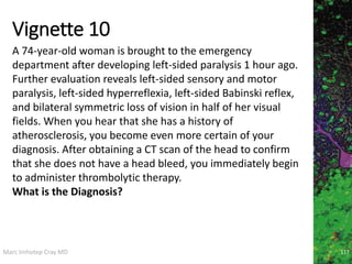 Marc Imhotep Cray MD
Vignette 10
117
A 74-year-old woman is brought to the emergency
department after developing left-sided paralysis 1 hour ago.
Further evaluation reveals left-sided sensory and motor
paralysis, left-sided hyperreflexia, left-sided Babinski reflex,
and bilateral symmetric loss of vision in half of her visual
fields. When you hear that she has a history of
atherosclerosis, you become even more certain of your
diagnosis. After obtaining a CT scan of the head to confirm
that she does not have a head bleed, you immediately begin
to administer thrombolytic therapy.
What is the Diagnosis?
 