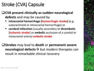 Marc Imhotep Cray MD
Stroke (CVA) Capsule
CVA present clinically as sudden neurological
defects and may be caused by
 intracranial hemorrhage (hemorrhagic stroke) (e.g.
subarachnoid or intracranial hemorrhage) or
 cerebral infarction (usually secondary to thrombotic
[ischemic stroke] or embolic occlusion of a carotid or
intracranial artery) embolic stroke
Strokes may lead to death or permanent severe
neurological defects but modern therapies can
result in remarkable clinical recovery
118
 