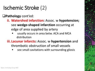 Marc Imhotep Cray MD
Ischemic Stroke (2)
120
Pathology cont’ed:
ii. Watershed infarction: Assoc. w hypotension;
see wedge-shaped infarction occurring at
edge of area supplied by artery
 usually occurs in area betw. ACA and MCA
distribution
iii.Lacunar infarcts: Assoc. w hypertension and
thrombotic obstruction of small vessels
 see small cavitations with surrounding gliosis
 