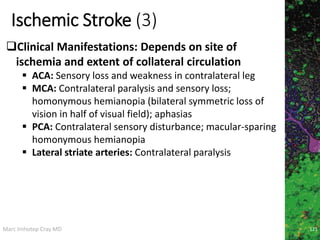 Marc Imhotep Cray MD
Ischemic Stroke (3)
121
Clinical Manifestations: Depends on site of
ischemia and extent of collateral circulation
 ACA: Sensory loss and weakness in contralateral leg
 MCA: Contralateral paralysis and sensory loss;
homonymous hemianopia (bilateral symmetric loss of
vision in half of visual field); aphasias
 PCA: Contralateral sensory disturbance; macular-sparing
homonymous hemianopia
 Lateral striate arteries: Contralateral paralysis
 
